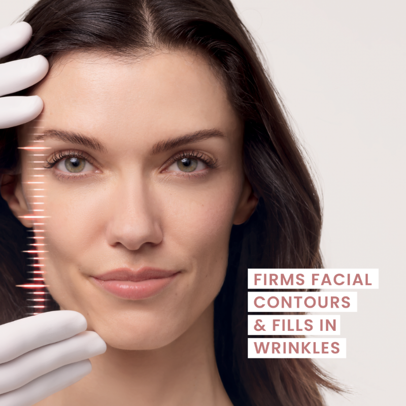 Avene Hyaluron Activ Micro-Lift Eye & Lip Cream l 0.05% Retinal 3x more active than retinol